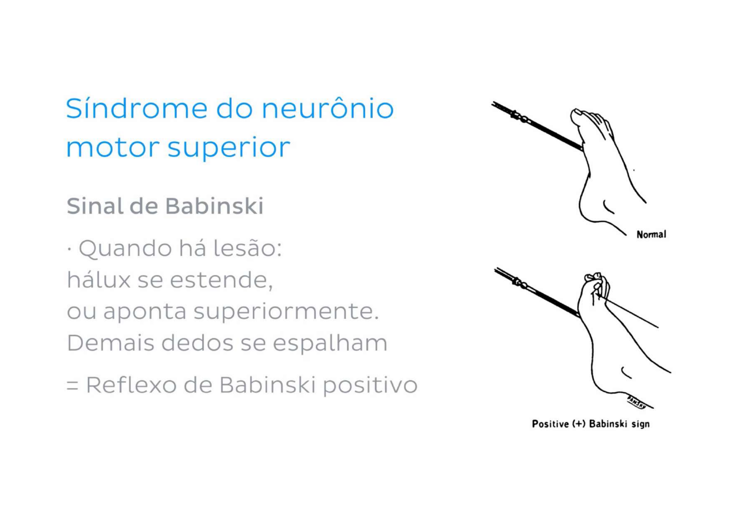 Sinal de Babinski