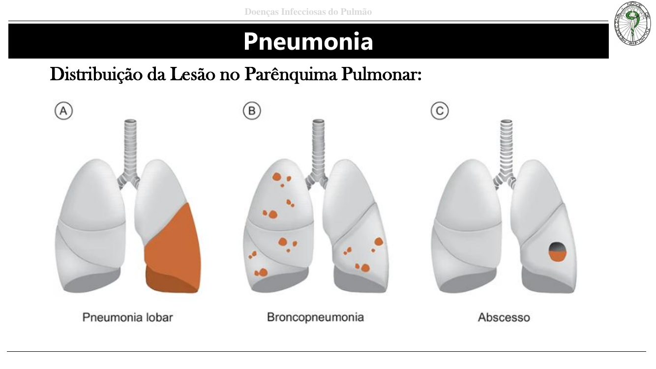 Pneumonia lobar vs broncopneumonia vs abscesso