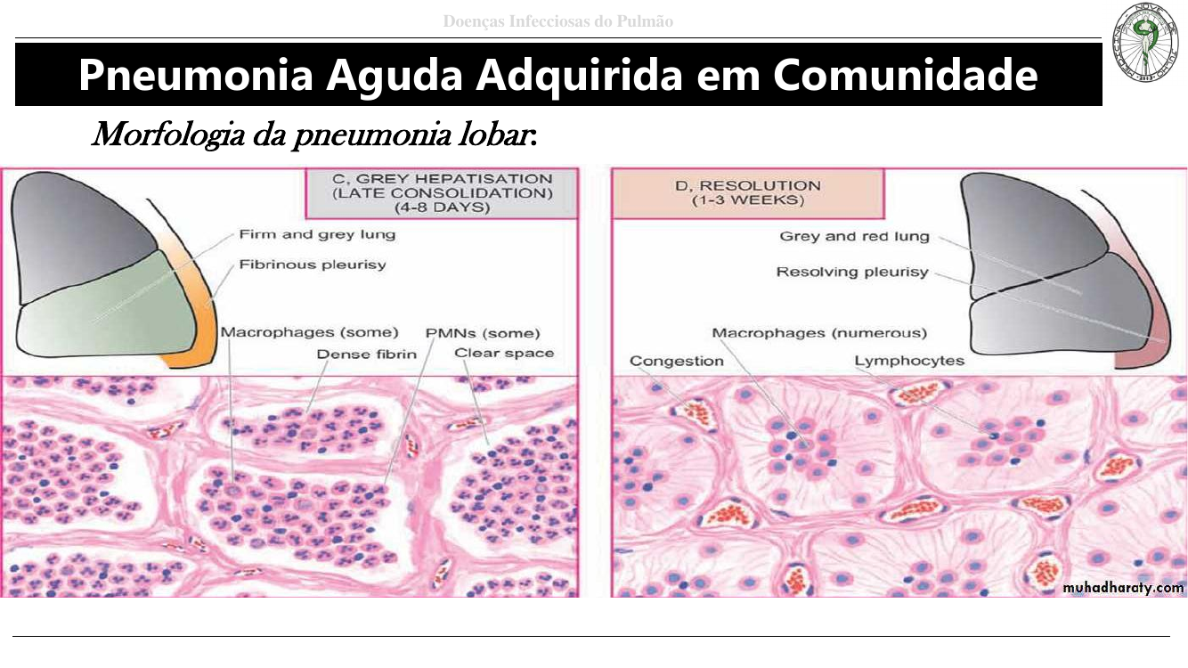 Fases hepatização cinzenta e resolução