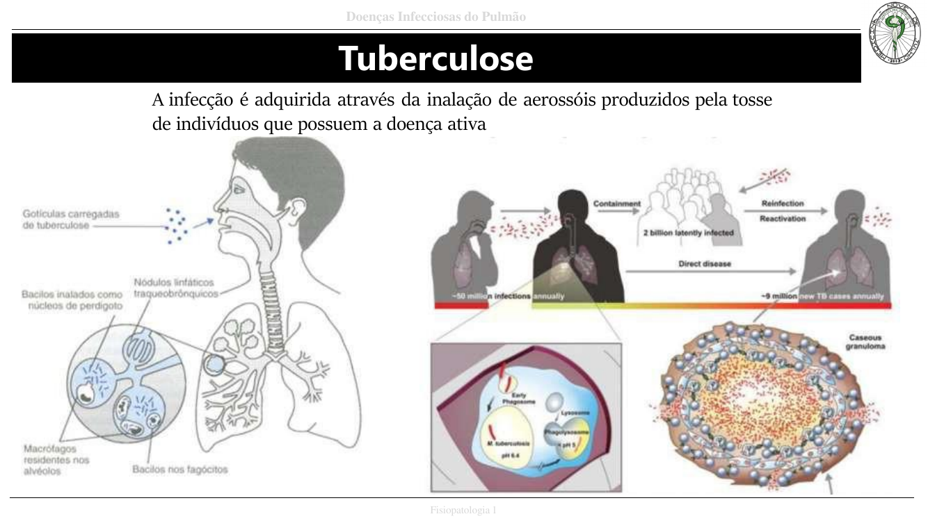 Tuberculose - cascata infecciosa