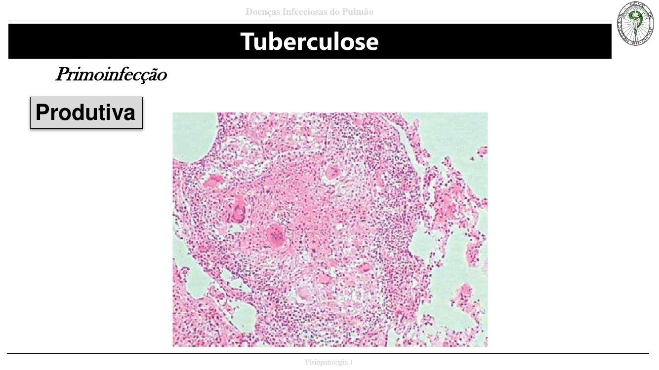 Primoinfecção produtiva micro