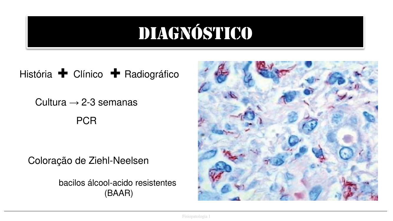 Ziehl-Neelsen diagnóstico