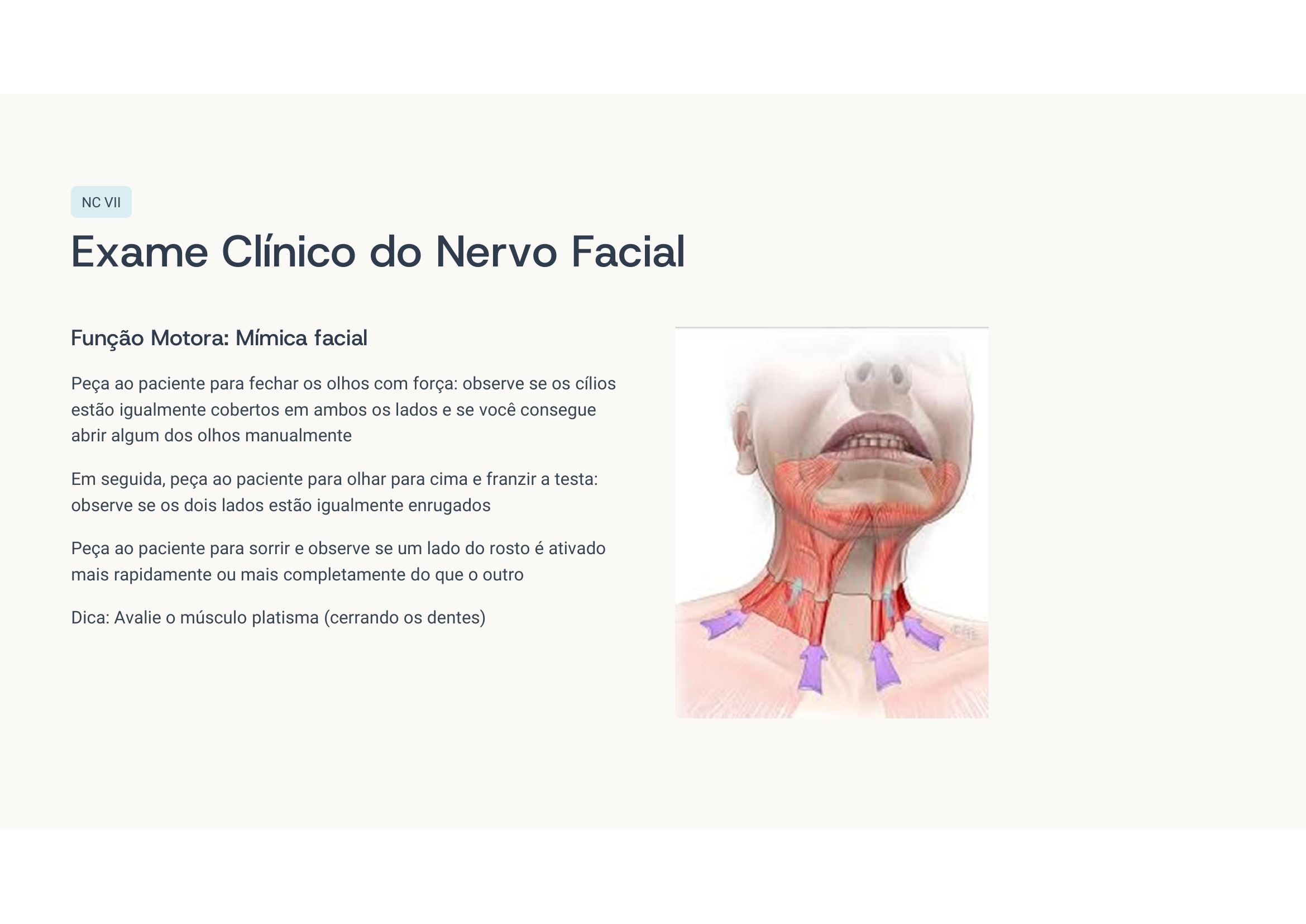 Exame motor do VII
